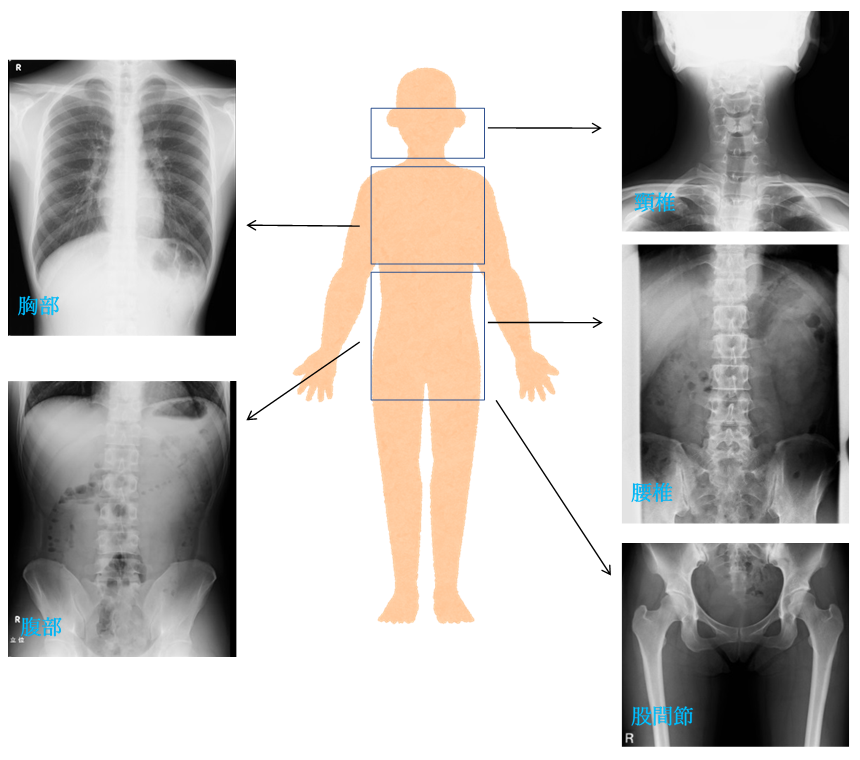 頭部、胸部、腹部の一般撮影検査画像の見本