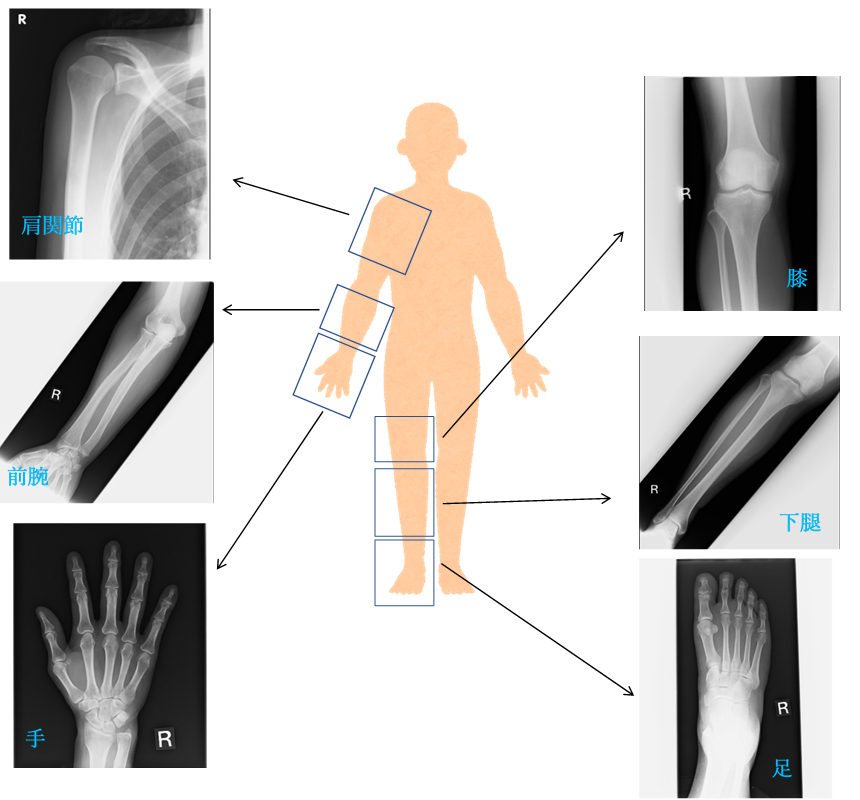 腕と足の一般撮影検査画像の見本