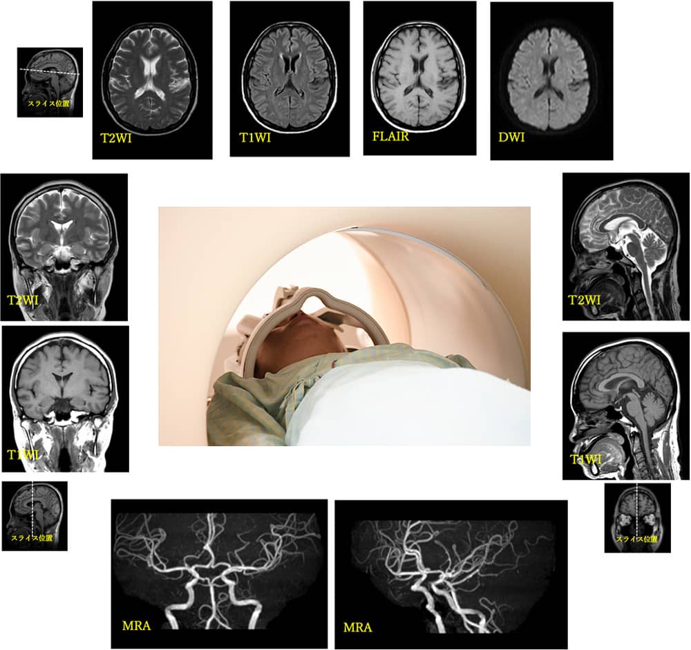 MRI検査画像の見本